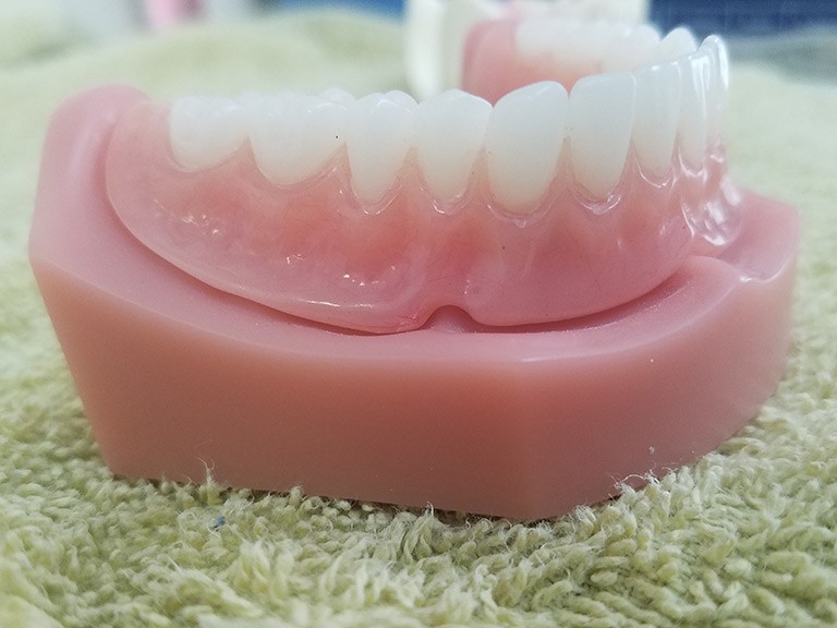 Jaw Registration For 
      Partial Dentures Opal WY 83124